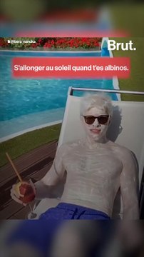 Albinos, ils parlent de leur maladie sur les réseaux sociaux