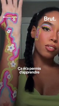 Elle transforme ses taches de vitiligo en art