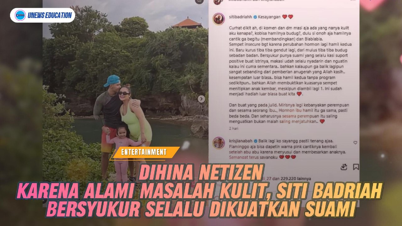 Dihina Netizen karena Alami Masalah Kulit, Siti Badriah Bersyukur Selalu Dikuatkan Suami
