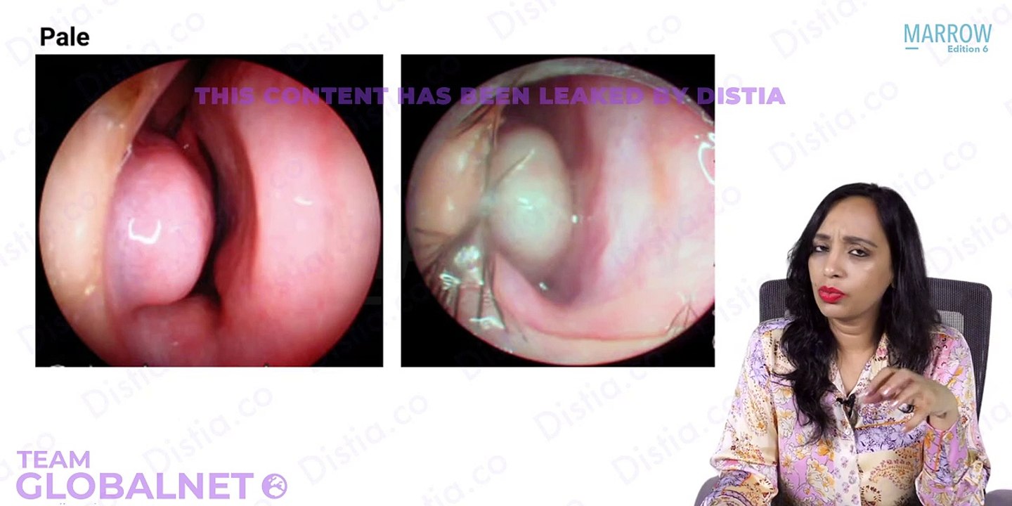 38. Nerve supply nose and diseases part 1