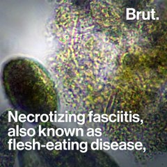 What is Flesh-Eating Bacteria?