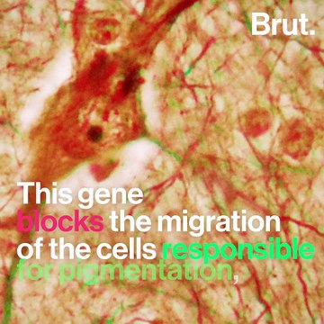 Why house cats with white fur are often deaf