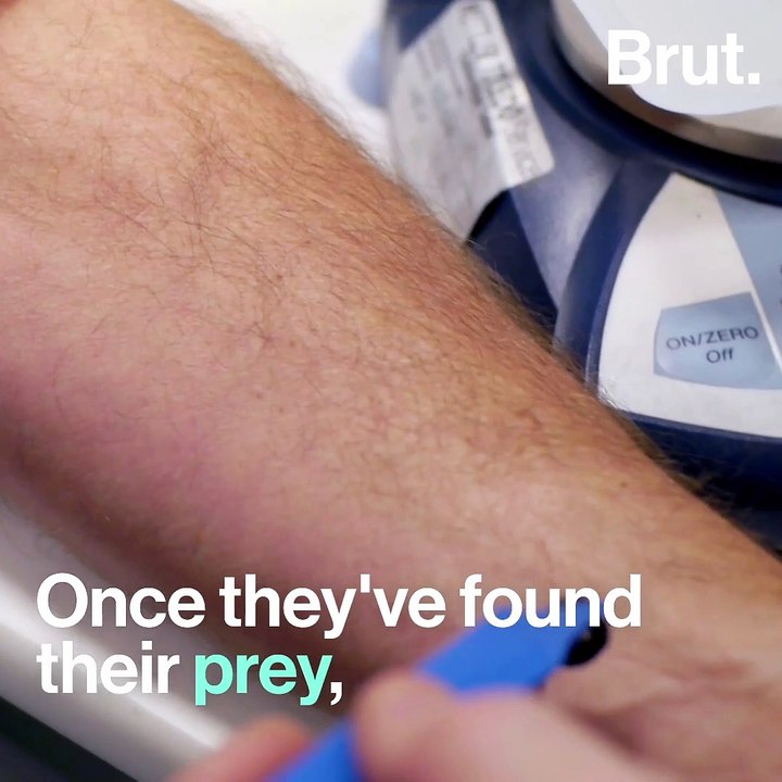 Leeches, a valuable tool in hospitals