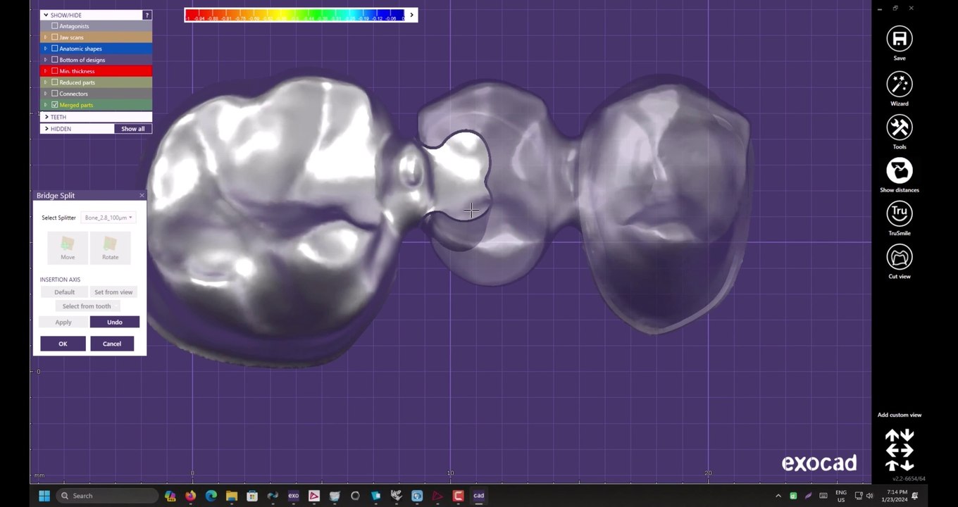 How to split a framework bridge in exocad