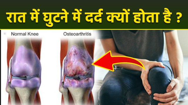 Knee Pain At Night: रात को सोते समय घुटनों में दर्द क्यों होता है | Reason & Treatment | Boldsky