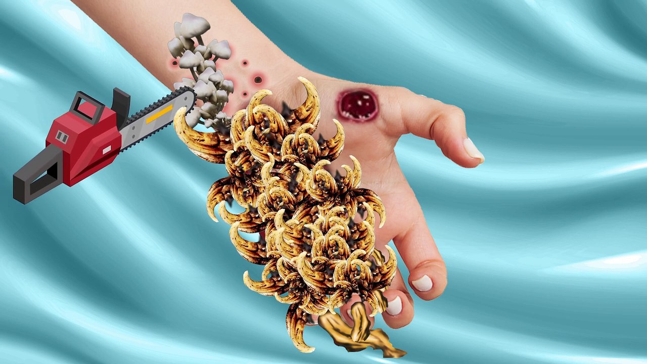 22. ASMR Remove Maggot & Dog Ticks Infected Hand   Deep Cleaning ASMR Animation