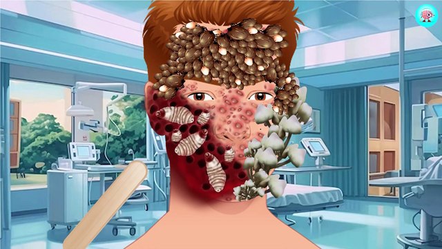 20. ASMR Remove Dog Ticks, Big Pustules, Maggots on the face asmr animation