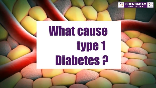 Stem Cell Therapy for Type 1 Diabetes - Benefits & Treatment Explained - Shenbagam Diabetes Clinic