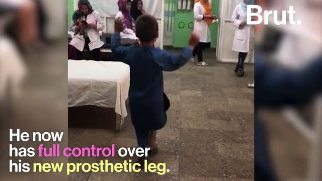 Afghan Boy Dances On New Prosthetic Leg