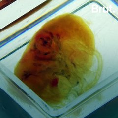 Transparent Human Organs