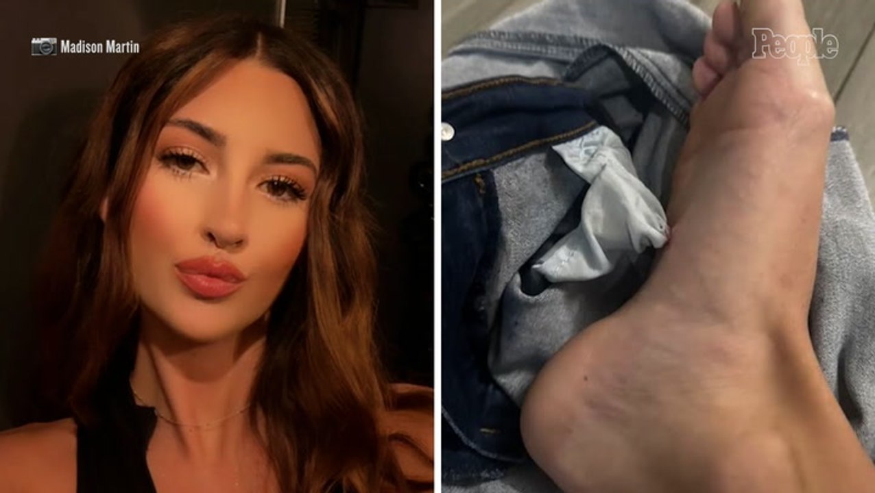 Woman Hears ‘Crunch’ After Stepping on Clothes Left on the Floor. She's Shocked at What She Sees Next (Exclusive)