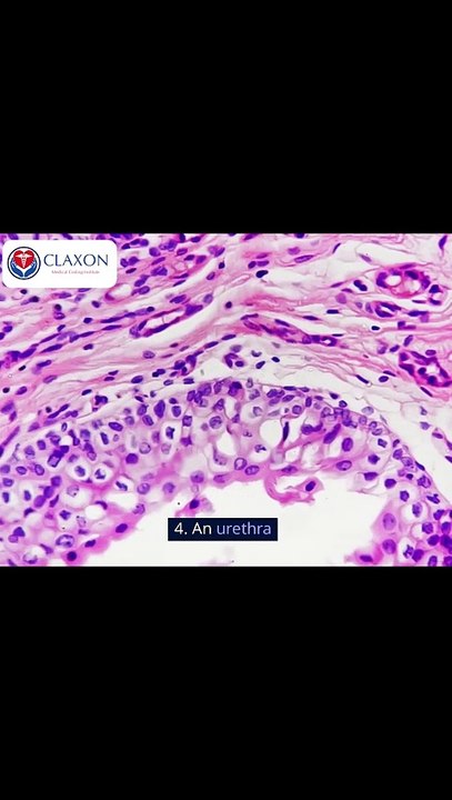 💧 Understanding the Urinary System: How Your Body Removes Waste Efficiently