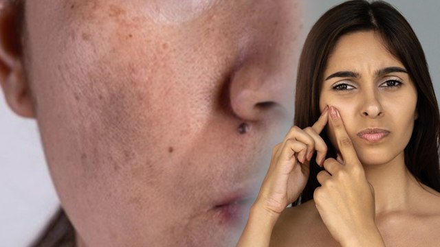 Face Bloating Causes: चेहरे पर सूजन क्यों होती है, Swealing Reason & Home Remedies...
