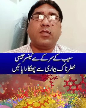 سیب کے سرکے سے کینسر کا علاج