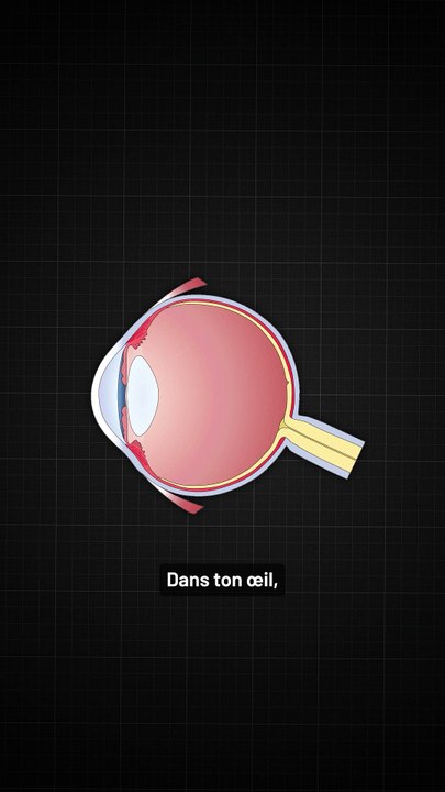 Des objets étranges dans ton champ de vision ?!