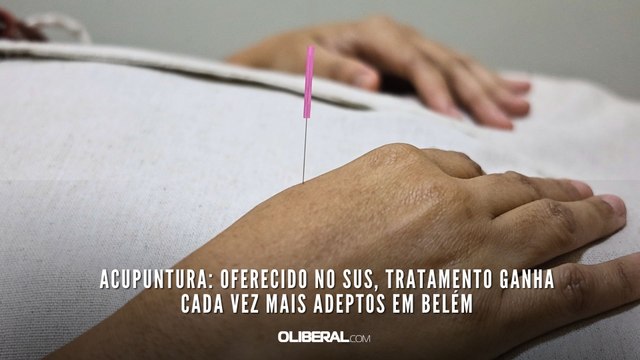 Acupuntura: oferecido no SUS, tratamento ganha cada vez mais adeptos em Belém