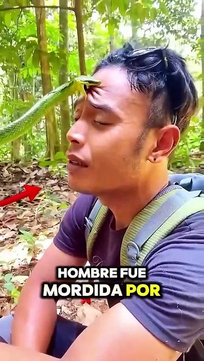 MORDIDA SERPIENTE