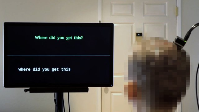 Así ha vuelto a hablar la superviviente de un derrame cerebral gracias a un implante cerebral