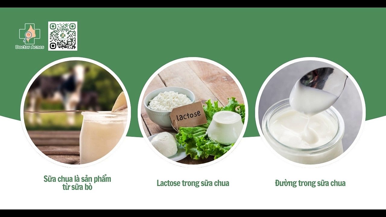 Bị mụn có nên ăn sữa chua không? Nên ăn thế nào cho đúng