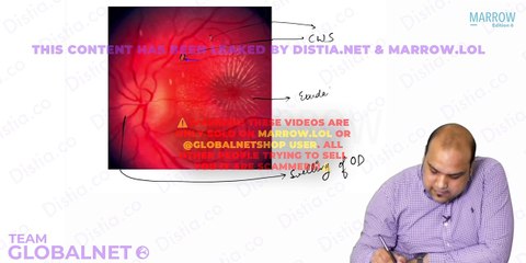 28. Retina - Vascular Disease Part 2