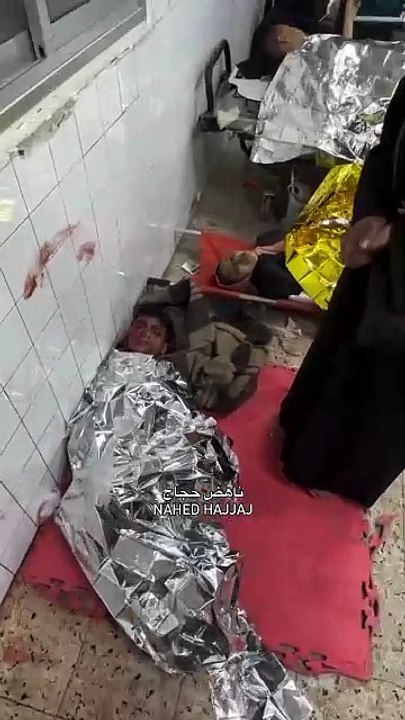 Dozens of injuries, most of them children, receive treatment at the Baptist Hospital following the massacre committed by the occupation warplanes after bombing Dar Al-Arqam School