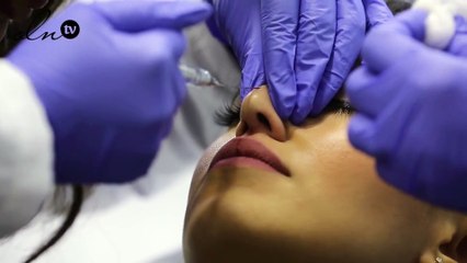 هكذا تحصلين على أنف جميل دون جراحة