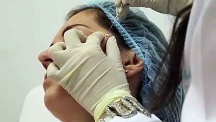 اكتشفي كيف تساعدك تقنية الـThreads على تجديد شباب البشرة