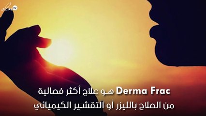 جرّبت لكم: علاج Derma Frac لإزالة تصبّغات الشمس من دون ألم