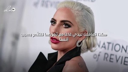 هكذا تعاملت ليدي غاغا مع تعرّضها للتنّمر بسبب أنفها!