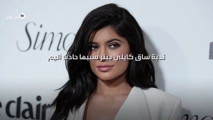ندبة ساق كايلي جينر سببها حادث أليم