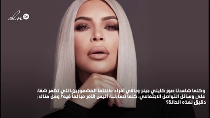 من ترّهل البشرة وصولاً إلى الجراحات، هذا ما يحدث إن بالغتِ في استخدام الفيلرز