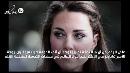 قراصنة يهدّدون كيت ميدلتون بالإفصاح عن صور عمليات التجميل التي أجرتها