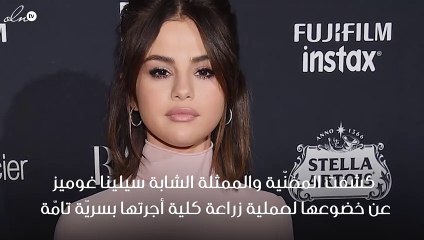 سيلينا غوميز تكشف عن عمليتها الجراحية لزرع الكلية، ولكن من المتبرّع؟