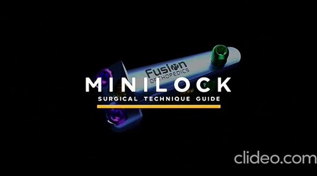 Best minilock service provider in USA