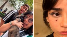 Alana Flores, novia de Sebastián Cáceres, se lastima rescatando a su gato