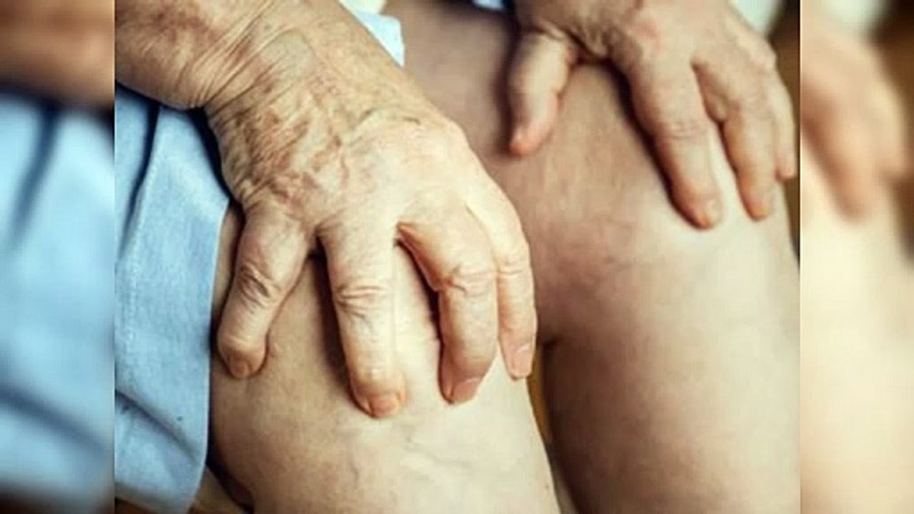 Las várices en el embarazo deben evaluarse a tiempo