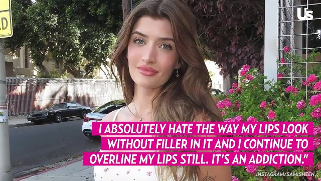 Sami Sheen Lists All of the Cosmetic Surgery Procedures She’s Had Done