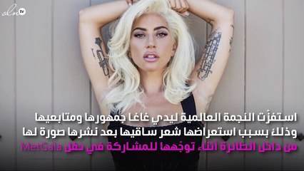 ليدي غاغا تستفز متابعيها باستعراض شعر ساقها!