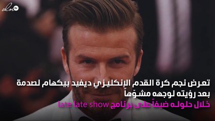 ديفيد بيكهام يتعرض لصدمة والسبب تشويه وجهه