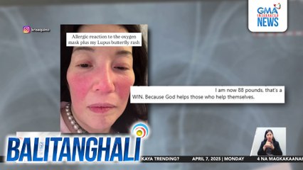 Tubong nakadugtong sa ugat ni Kris Aquino, kinailangang palitan; nagkaroon siya ng allergic reaction dahil sa oxygen mask | Balitanghali