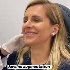 وداعاً للبوتوكس؛ إجراء تجميلي جديد يعزّز جمالكِ الطبيعي