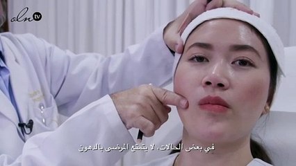 فيديو يكشف لكِ كيف تحصلين على غمّازات وعلى وجه أنحف