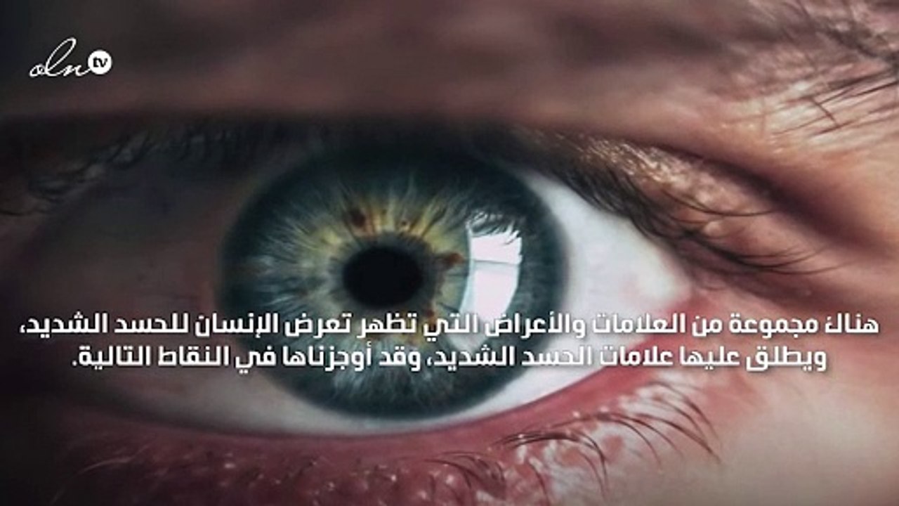 علامات الحسد