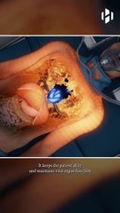 Artificial heart is now saving hundreds of lives from heart failure.