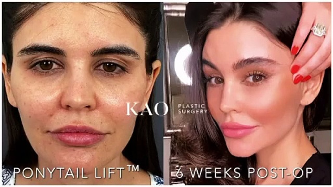 تقنية جديدة لشدّ الوجه في دبي، حقبة جديدة في عالم الجمال