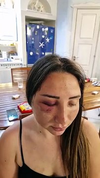 Gaia pestata a sangue dal suo ex Mi sono opposta altrimenti mi a