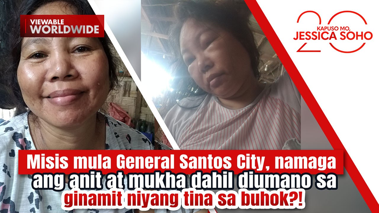 Misis, namaga ang anit at mukha dahil raw sa ginamit na tina sa buhok?! | Kapuso Mo, Jessica Soho