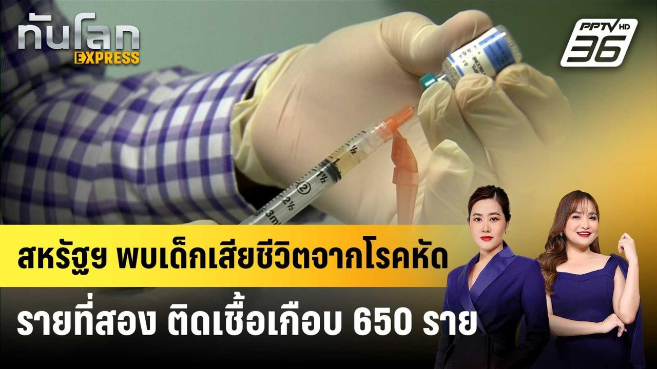สหรัฐฯ พบเด็กเสียชีวิตจากโรคหัดรายที่สอง ติดเชื...