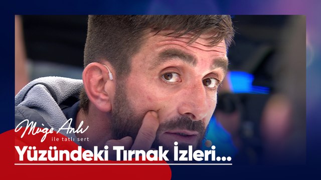 Arkadaşının yüzünde dikkat çeken tırnak izleri! - Müge Anlı ile Tatlı Sert 8 Nisan 2025