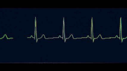 La vida de Chuck - Teaser tráiler oficial español